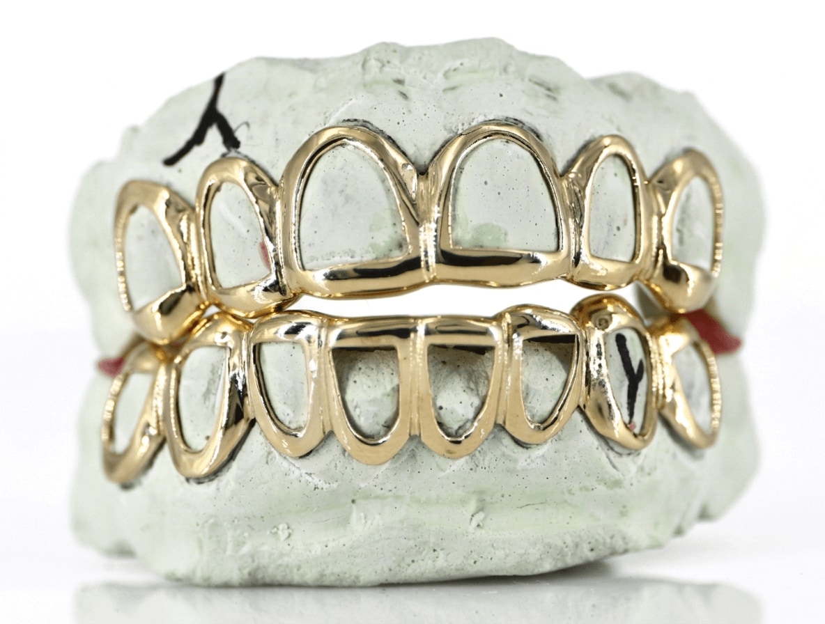 Gold open-face grillz on a dental mold