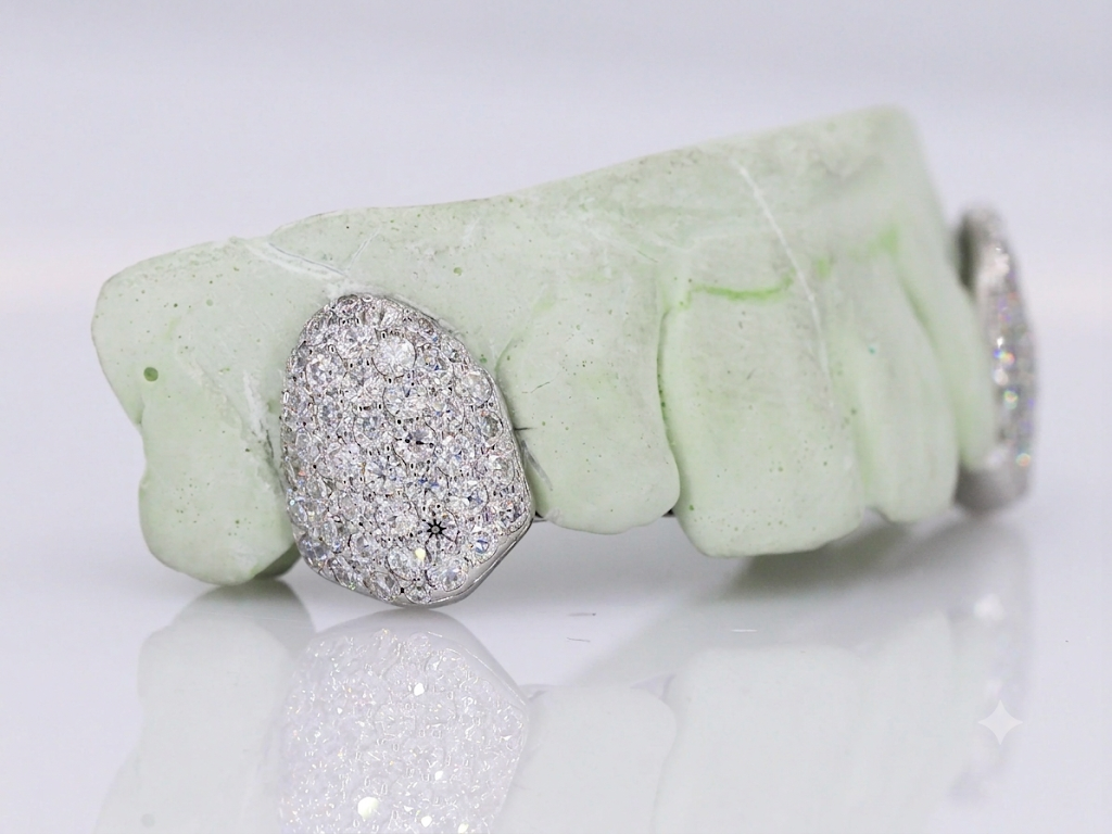 Single Tooth Pavé